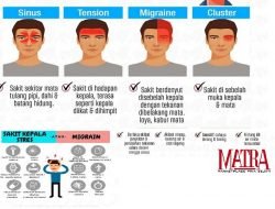 Perang Melawan Nyeri Sakit Kepala, Ini Caranya