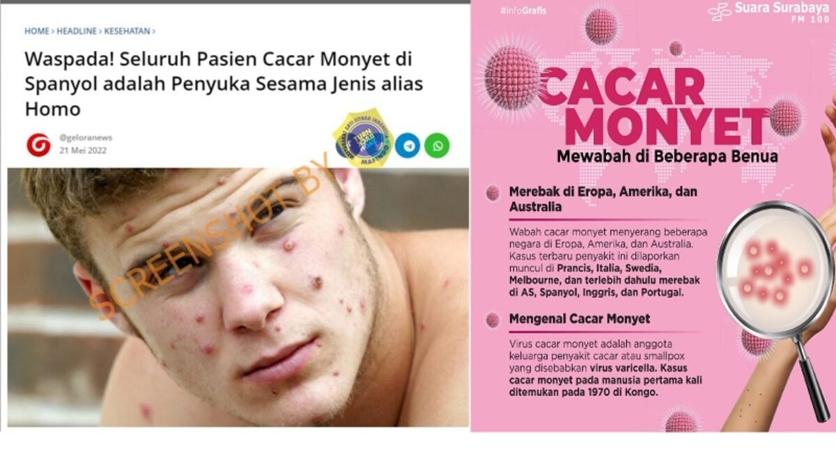 Waspada! Seluruh Pasien Cacar Monyet di Spanyol adalah Penyuka Sesama Jenis alias Homo Waspada! Seluruh Pasien Cacar Monyet di Spanyol adalah Penyuka Sesama Jenis alias Homo