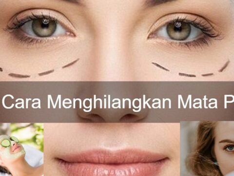 Cara Mengatasi Mata Panda, Klik ini 
