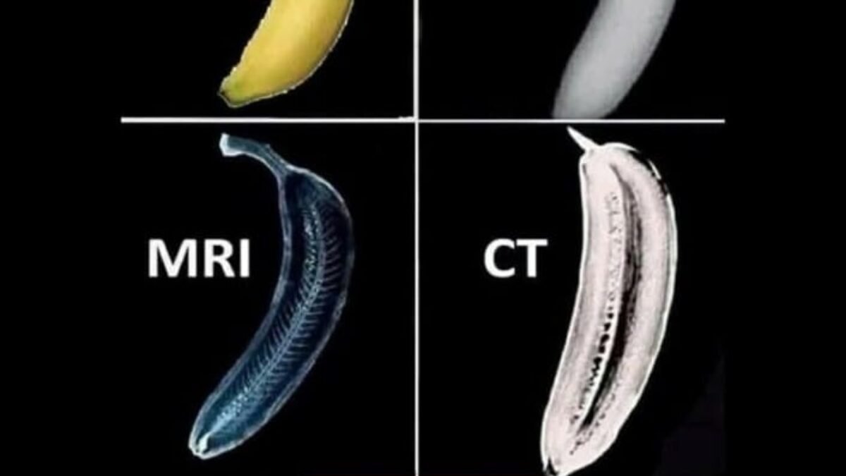 Perbedaan X-Ray, MRI, dan CT Scan: Mana yang Dibutuhkan?