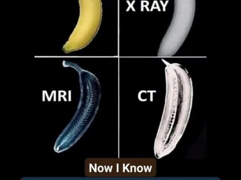 Perbedaan X-Ray, MRI, dan CT Scan: Mana yang Dibutuhkan?